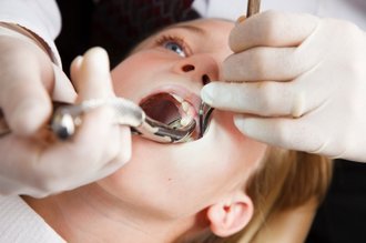 Fillings - Dentist In Depew, NY | Hillview Family Dental